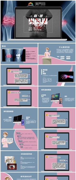 淡紅暗藍色類風濕關節(jié)炎科普模板