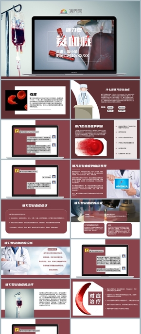 暗紅色鐮刀型貧血癥科普模板
