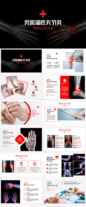 類風濕性關(guān)節(jié)炎疾病預防與治療PPT模板