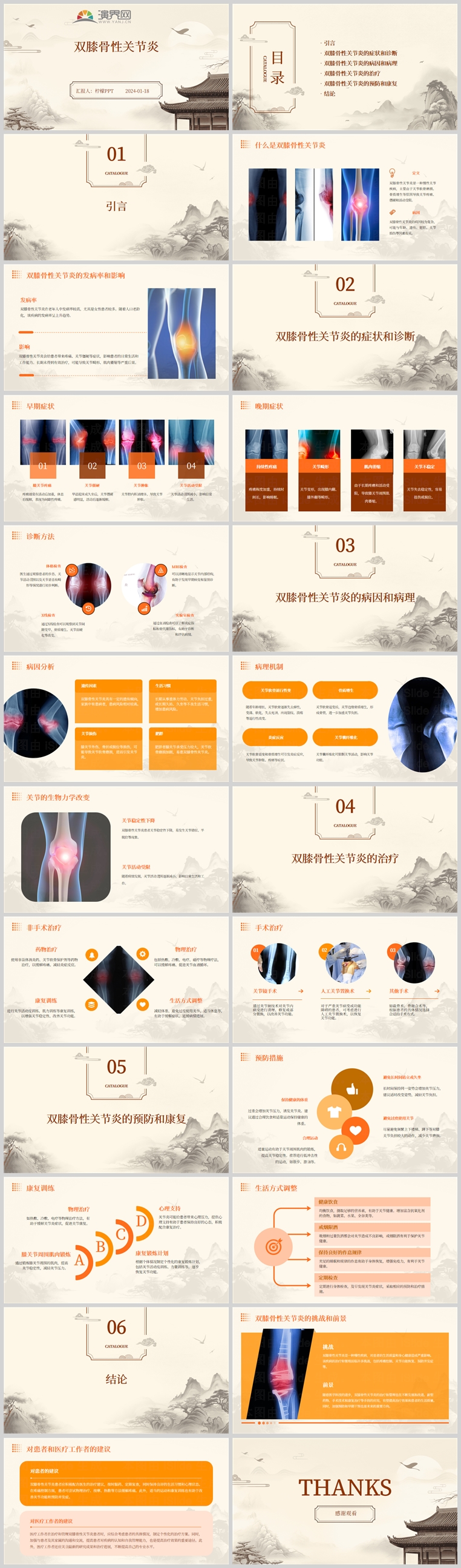 雙膝骨性關(guān)節(jié)炎